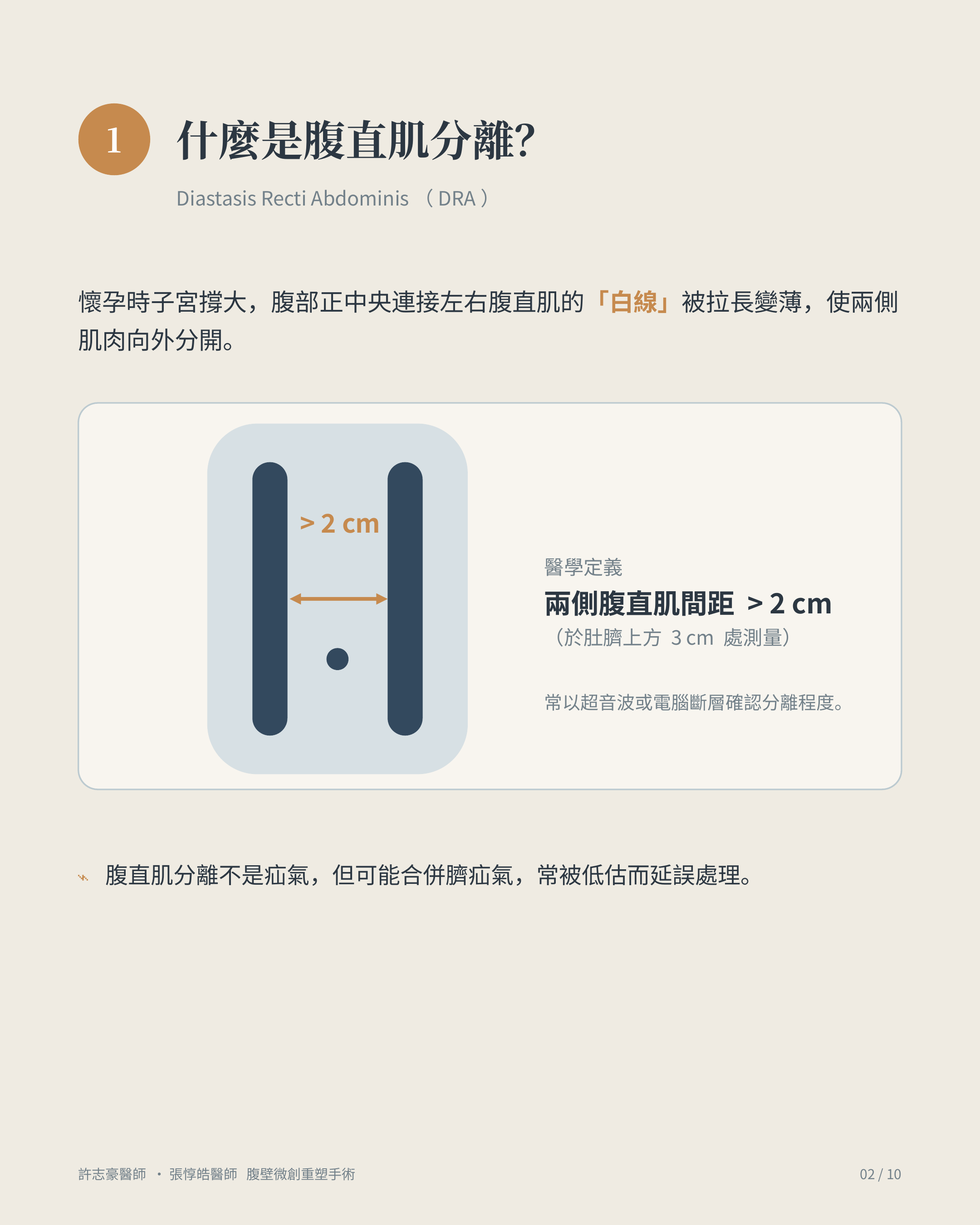 什麼是腹直肌分離：兩側腹直肌間距大於 2 公分