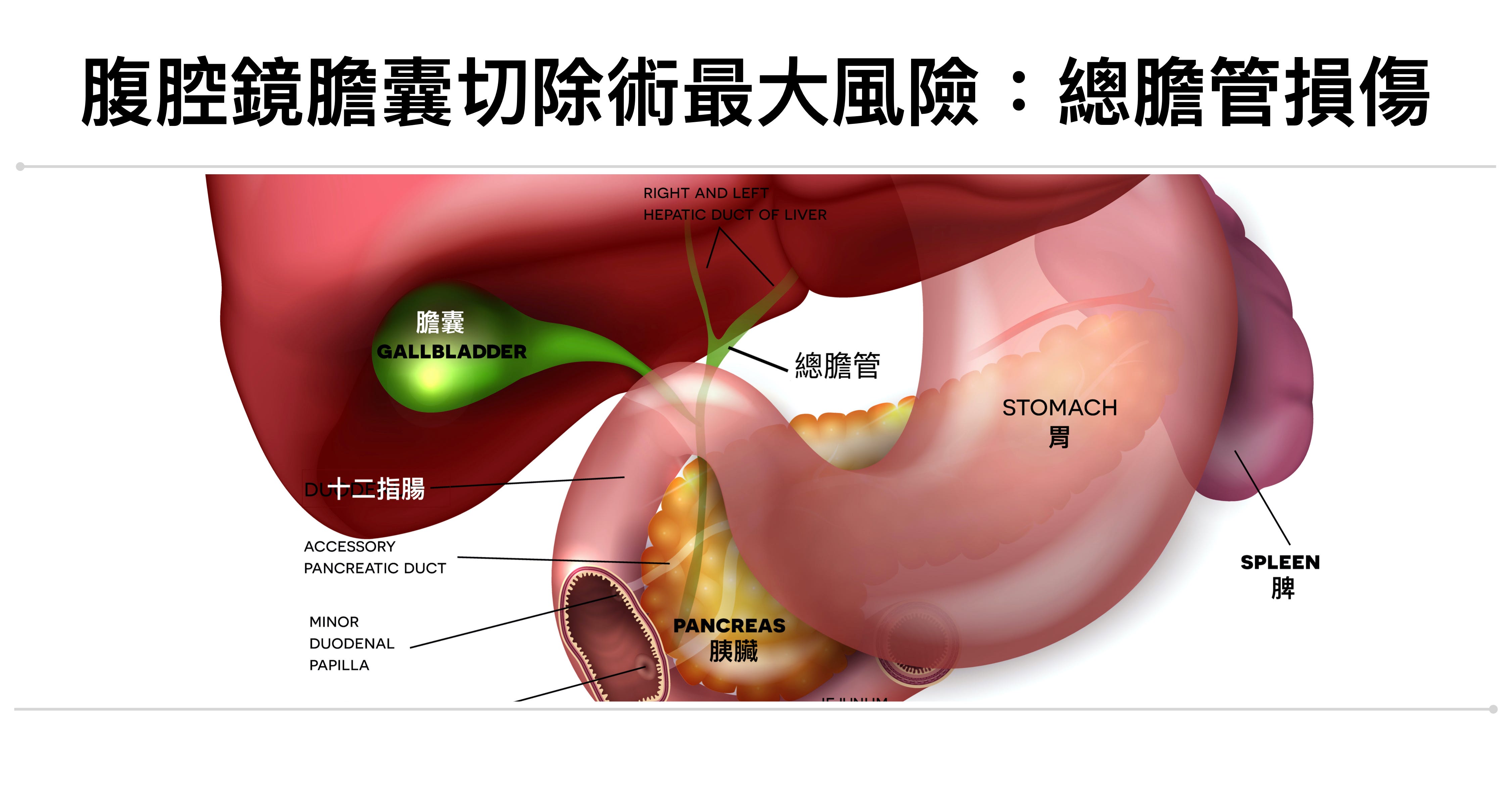 腹腔鏡膽囊切除術影像