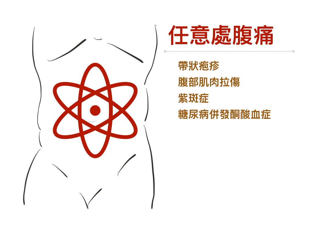任意處腹痛