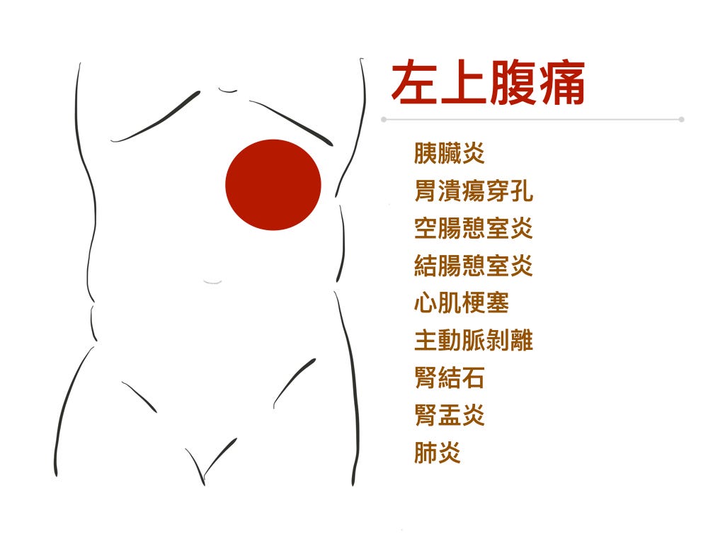 左上腹痛