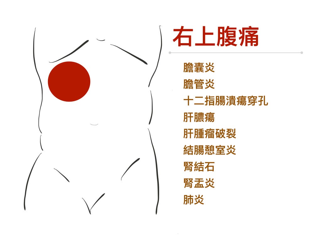 右上腹痛